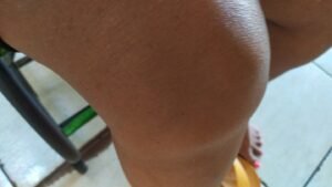 Leia mais sobre o artigo Evite a Cirurgia de Prótese no Joelho: O Guia Completo para Recuperar sua Mobilidade Naturalmente (Sem Procedimentos Invasivos)